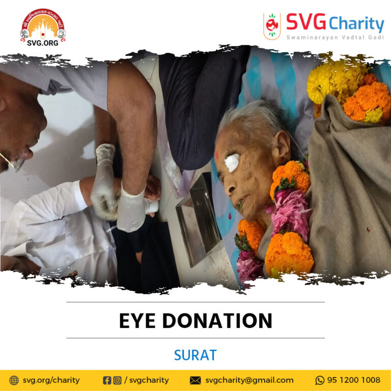 Surat Eye Donation 19 April 2022